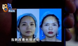 闺蜜整容前后爆料视频,揭秘整形术的神奇魔力